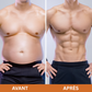 Pack EMS Complet - Stimulation Musculaire pour Abdos, Bras et Jambes