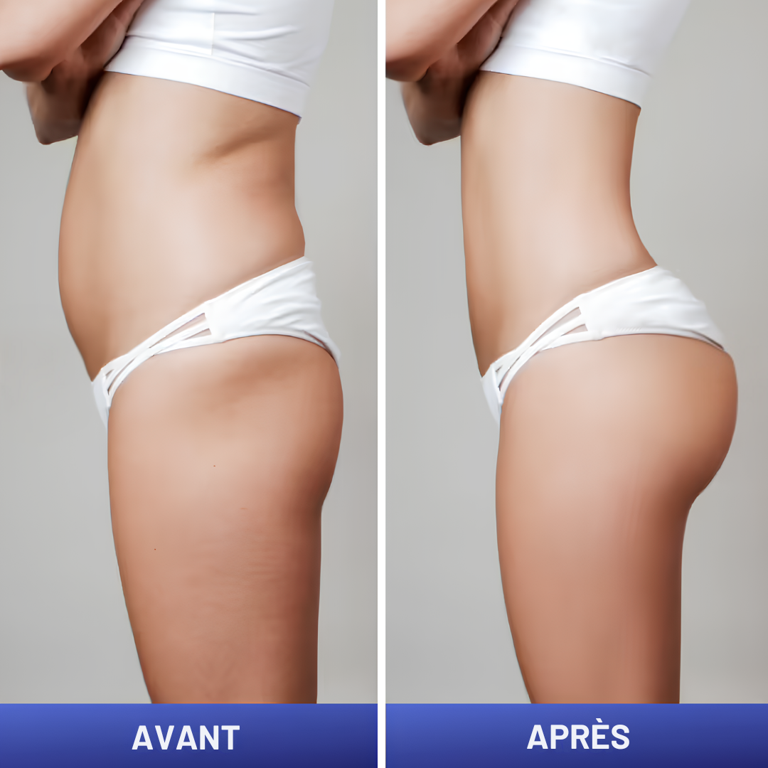 Ceinture massante EMS - Vmax
