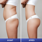 Ceinture de massage EMS - Pro+